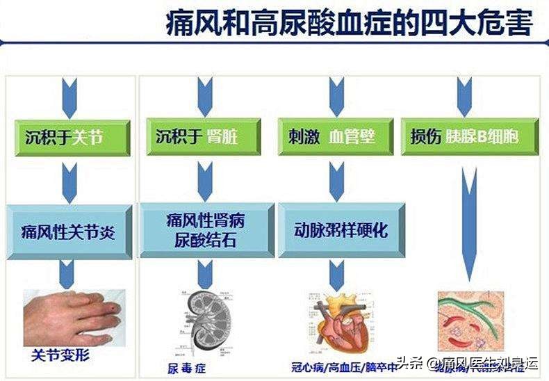 痛风吃什么中药有效治好,痛风吃什么药最快缓解