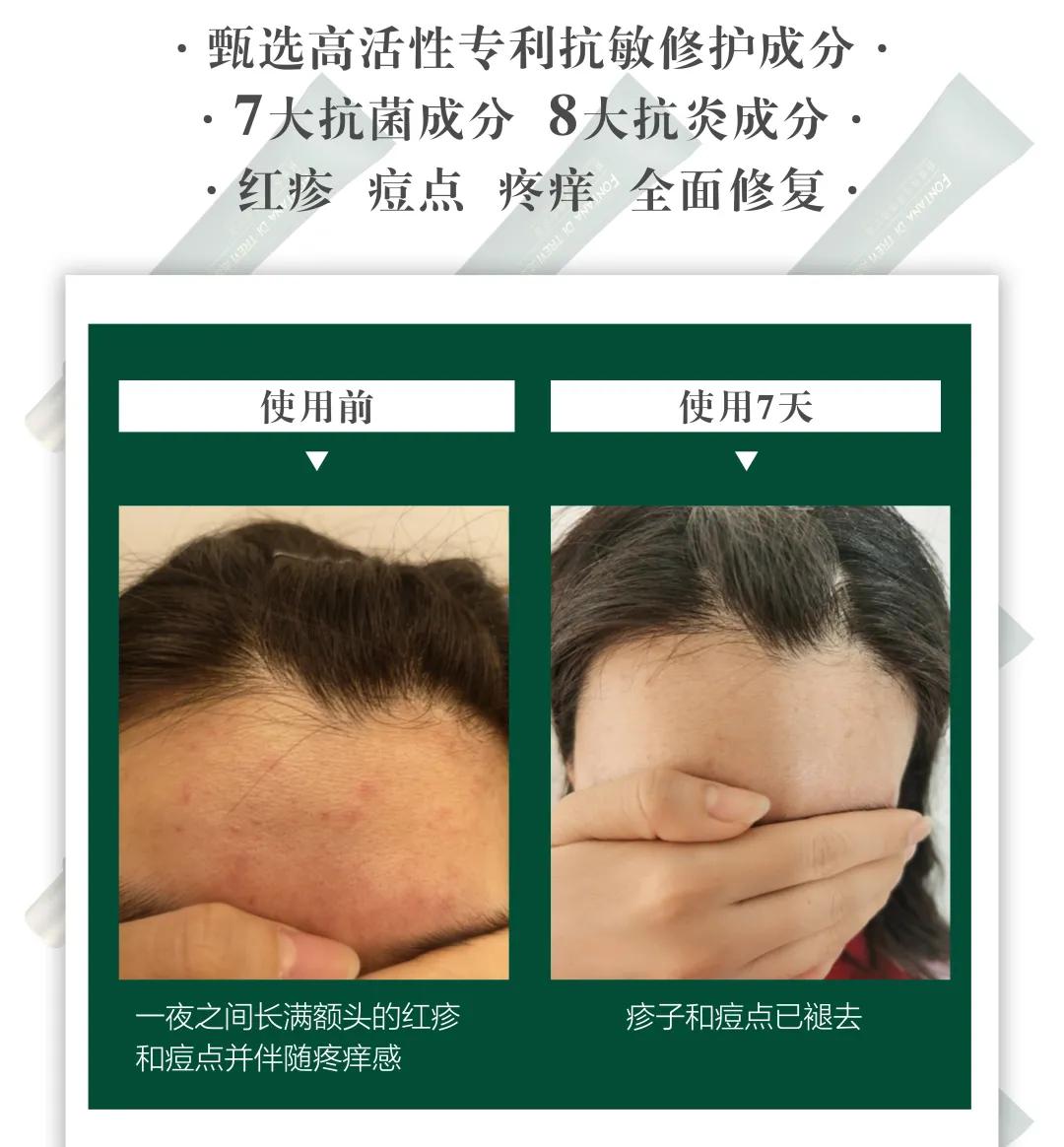 肌肤发红发痒怎么护理,泛红刺痛干痒如何修复