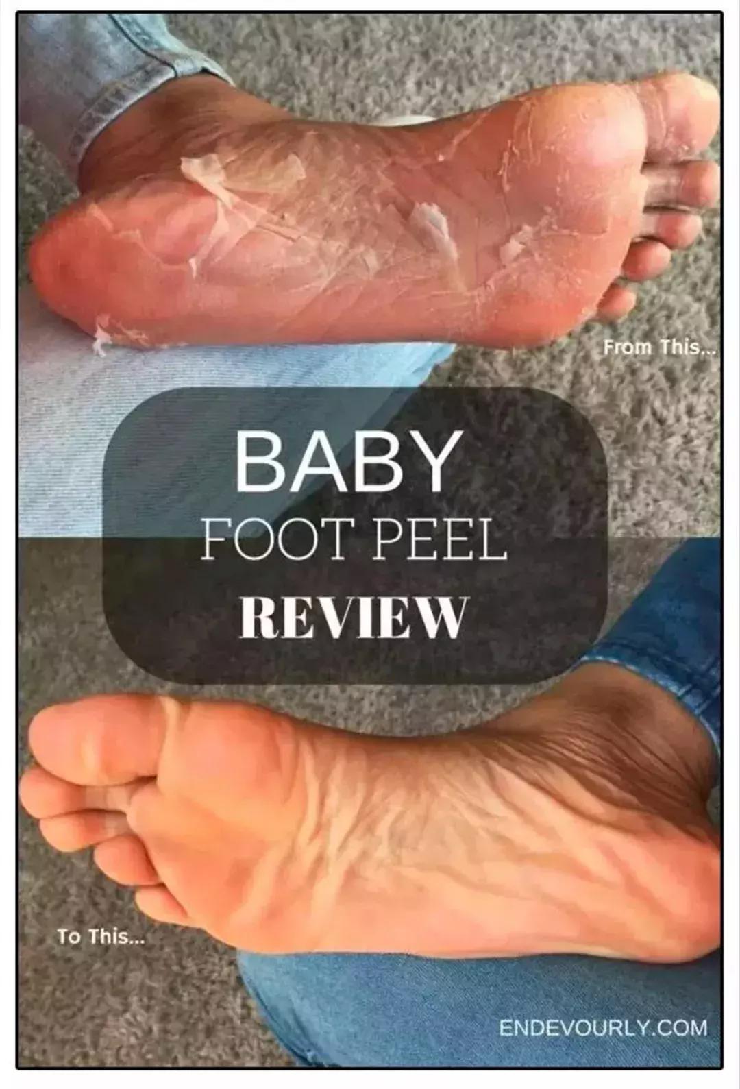 足部保湿护理,足部护理系列前脚贴