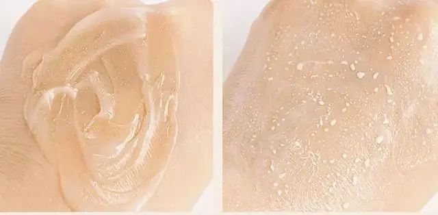 林允打的眼周水光针是什么,林允怎么那么有钱