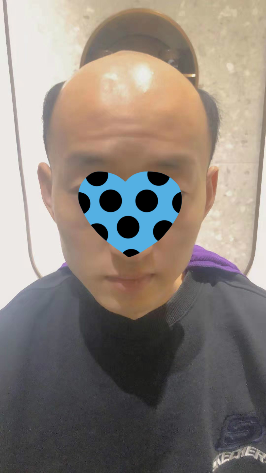 假发是越戴越逼真吗,真的有特别自然的假发吗