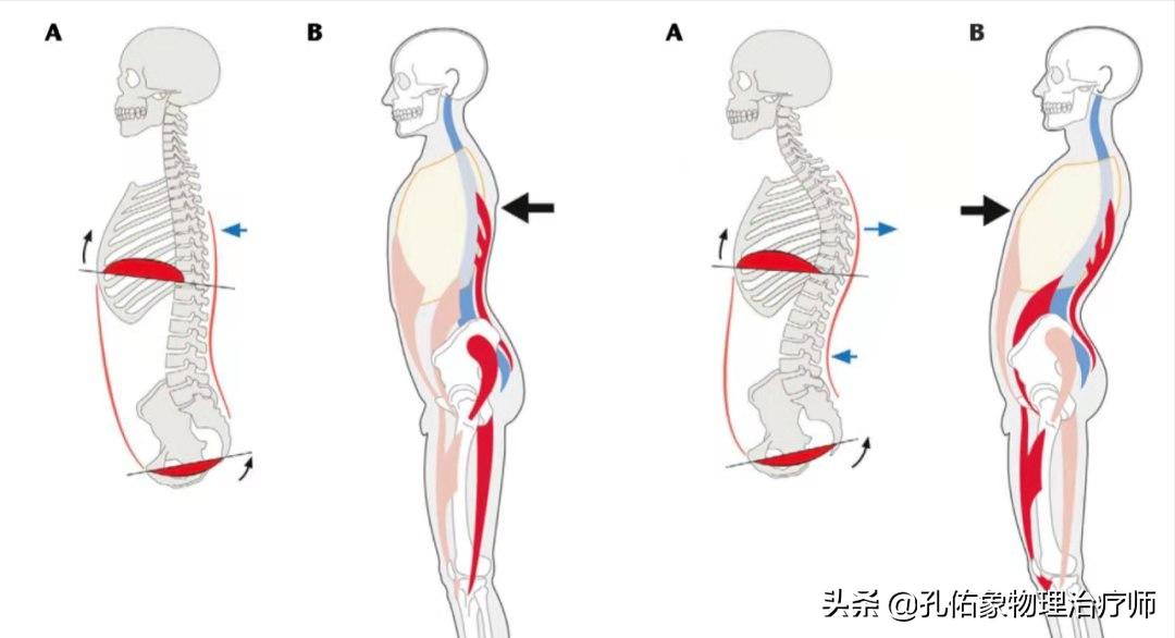 孕妈妈产后为什么会腰痛,产后三个月的宝妈腰酸腰疼咋回事
