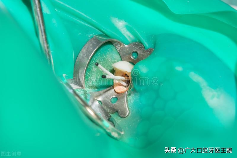 补完牙牙齿咬合有点怪怪的,牙齿不疼补完牙疼了