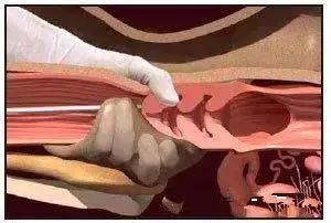 给牛人工授精注意哪些,给牛人工授精教学