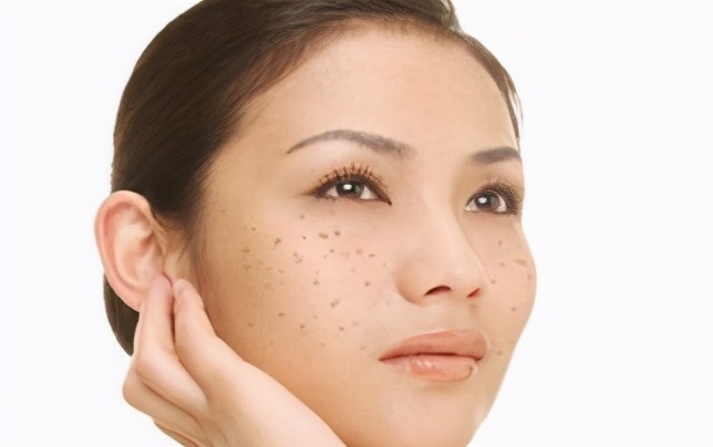 脸上的斑一直去不掉是怎么回事,脸上的色斑一直不消怎么办