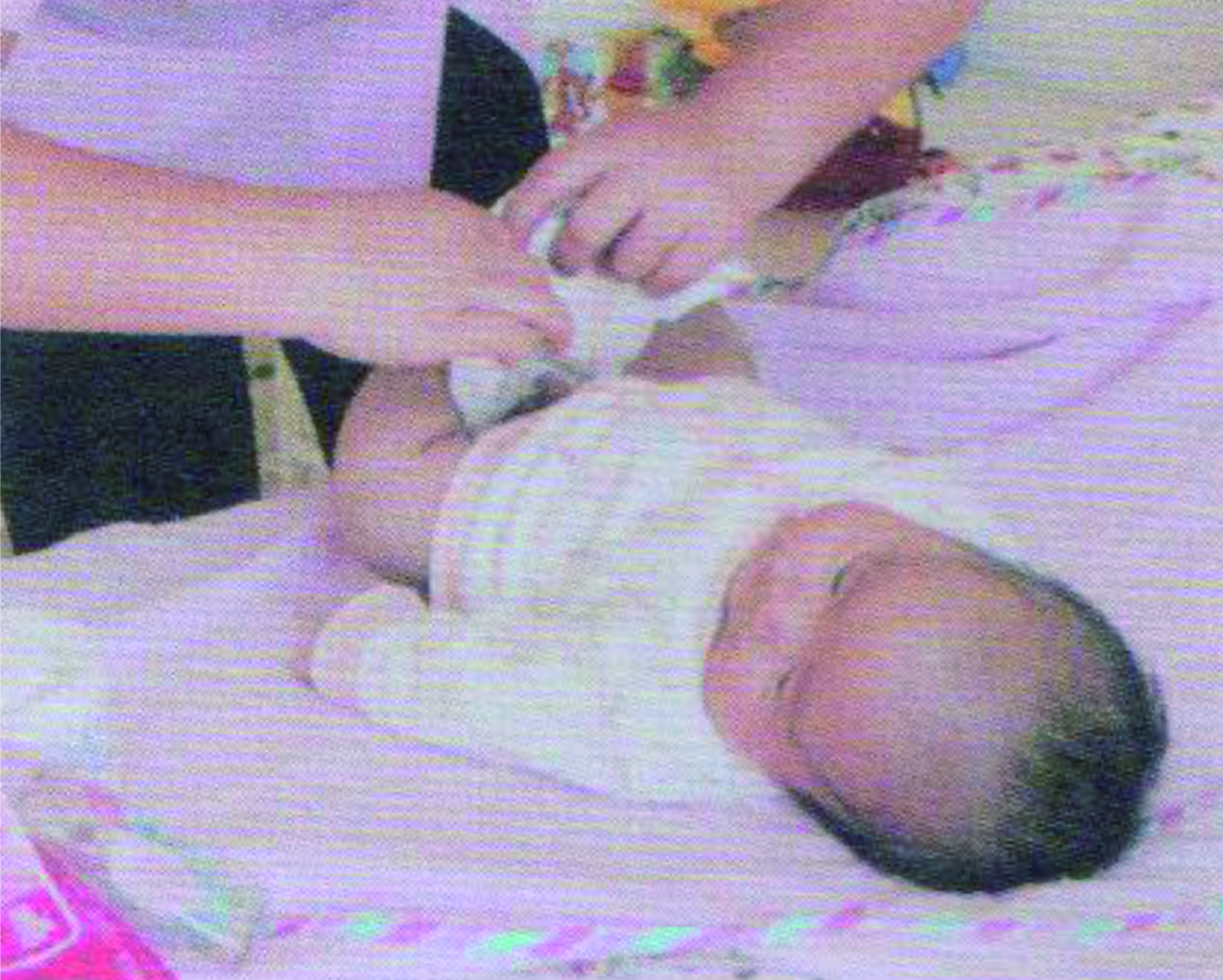 婴幼儿大小便的照顾与清洁实操,婴儿大小便照料照片