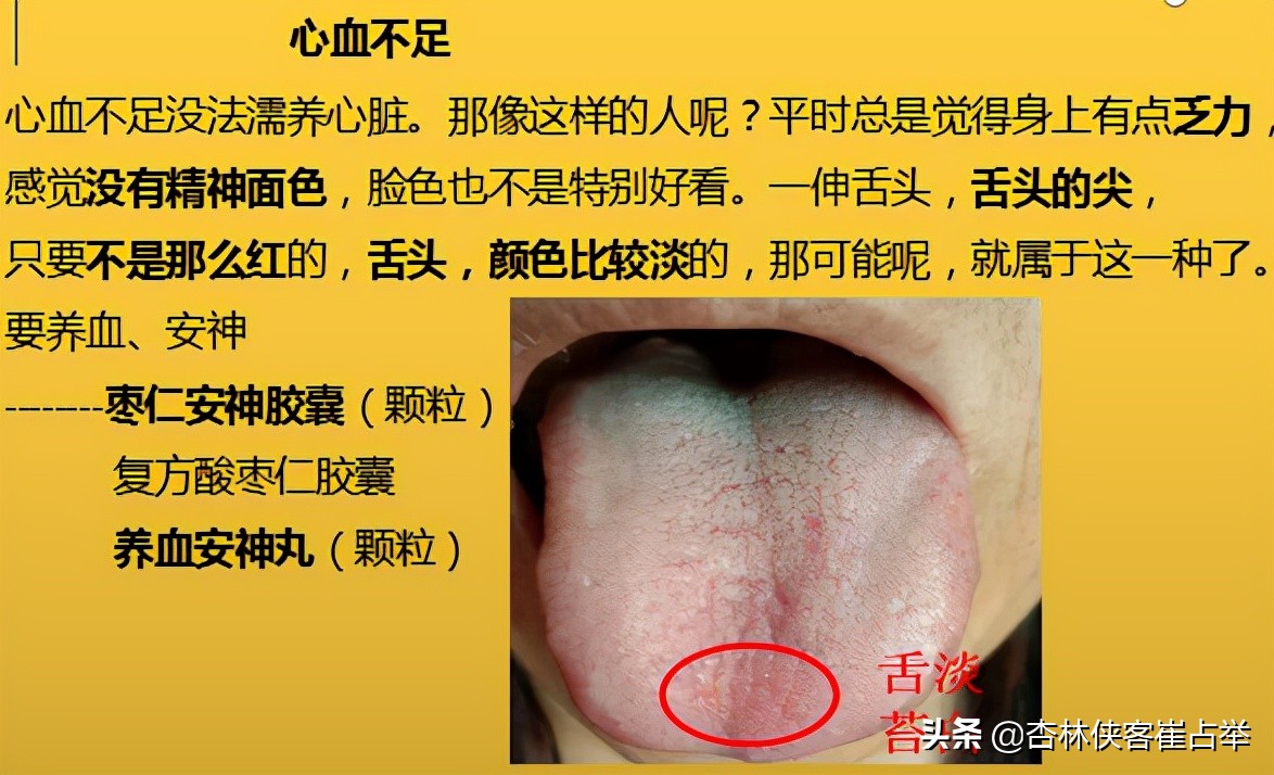 治疗失眠的十种中成药,治疗失眠多梦的中成药大全