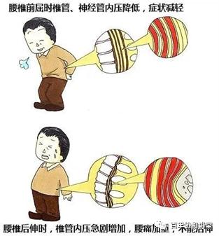 腰腿痛走路可以缓解是什么病,腰椎管狭窄腿疼晚上为啥疼得厉害