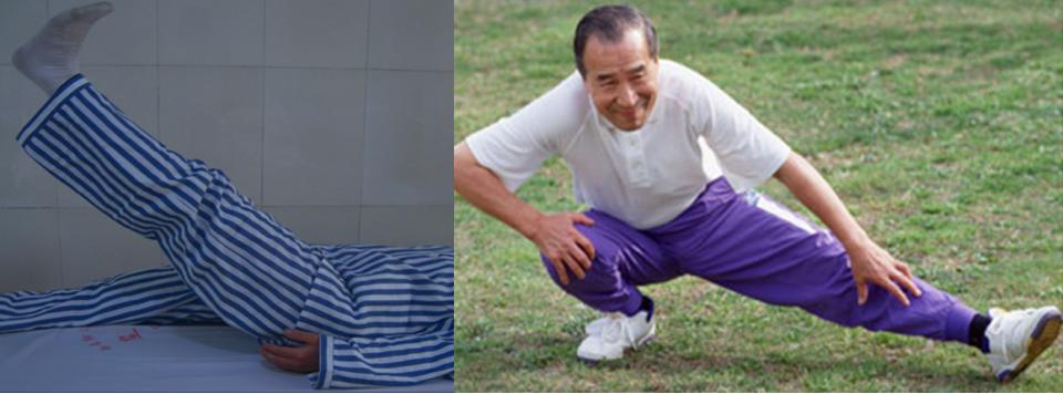 膝关节骨性关节炎症状及治疗,膝关节骨性关节炎诊疗指南下载