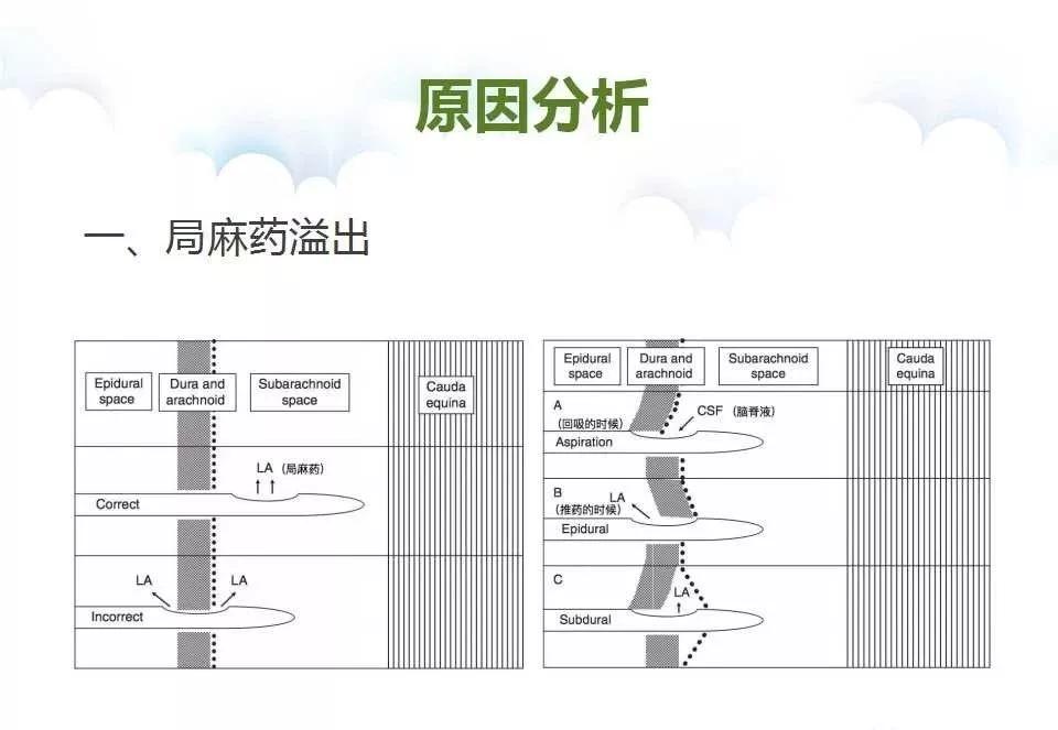 腰麻后不出脑脊液怎么办,腰麻脑脊液抽不出来