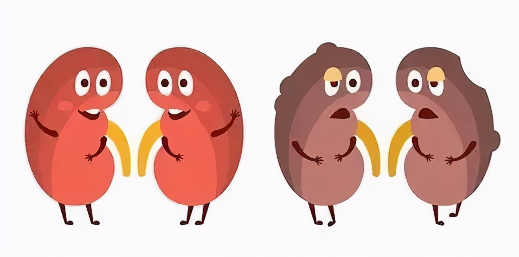 儿童肾病的隐形杀手,毛孩子得什么病