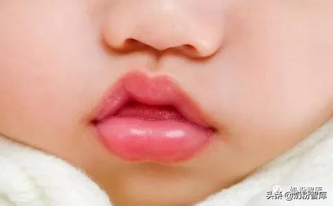 口唇干裂起皮是什么原因引起的,宝宝口唇干裂