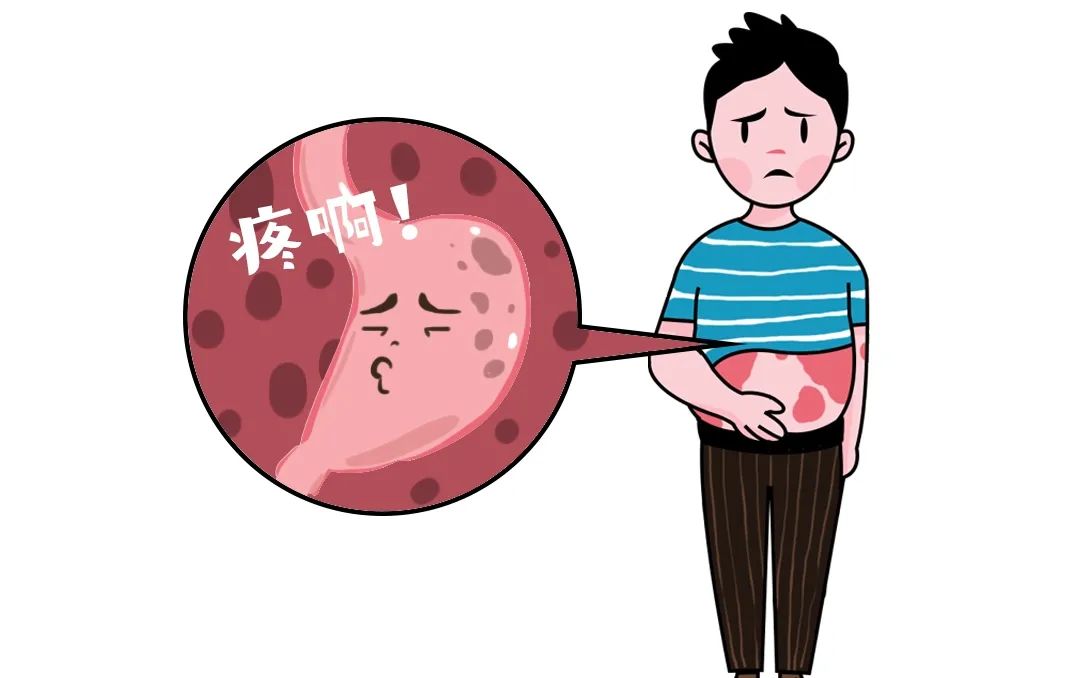 银屑病终身不能喝酒,银屑病患者喝酒了怎么办