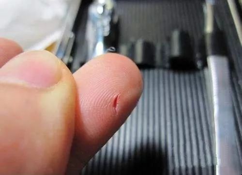 手指被水果刀切伤口很深怎么办,切水果划破手伤口