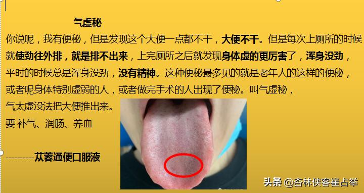 中医怎么治疗肠蠕动慢引起的便秘,糖尿病人长期便秘的中医解决方法