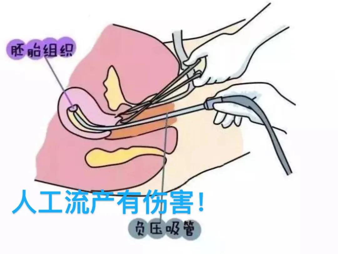 “今天人流!明天上班”真的是这样吗?