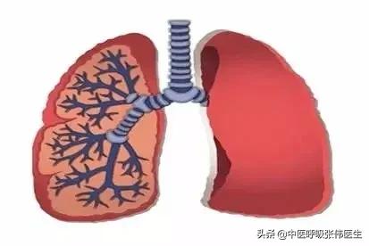 中医辨证论治肺病,中医怎么样治疗间质性肺病