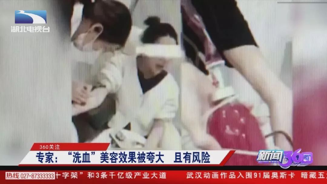 网红花5万赴日本“洗血”：这些自杀式美容法真是医美黑科技？