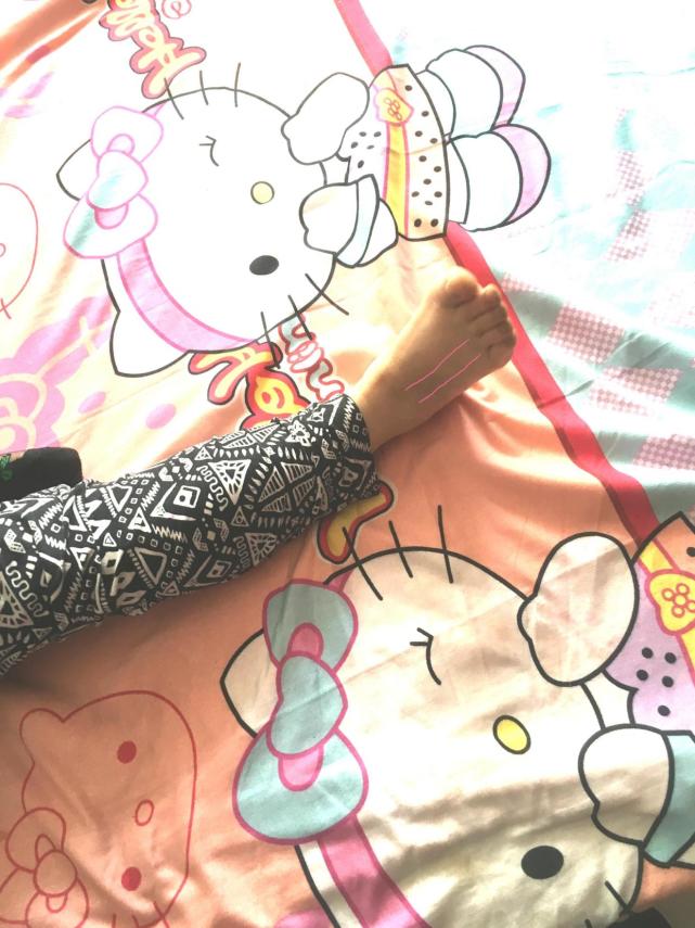 脚腕扭伤几年了脚腕还疼怎么运动,扭伤脚腕怎么处理