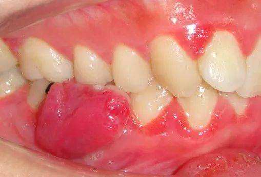 今天您正确刷牙了吗?