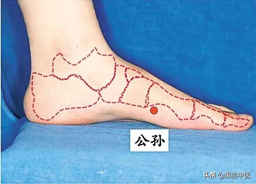 气虚型冠心病缓不过来气的急救穴,中医对心脏病的急救用穴是哪几个