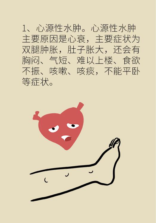 女性经期小腿以下水肿怎么办,起床肿怎么办