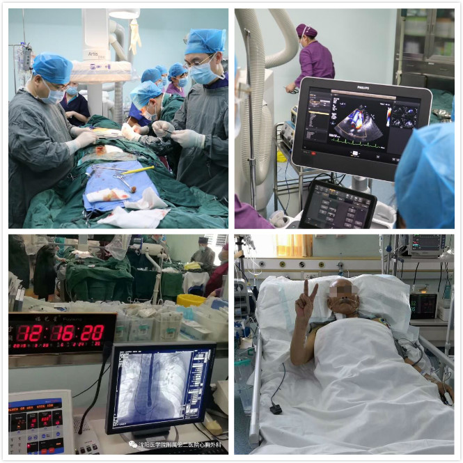 心血管病患者新希望——沈医二院成功完成一例TAVI手术