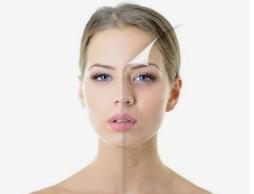 名门泽佳怎么去角质不伤皮肤,名门泽佳皮肤干燥怎么护肤