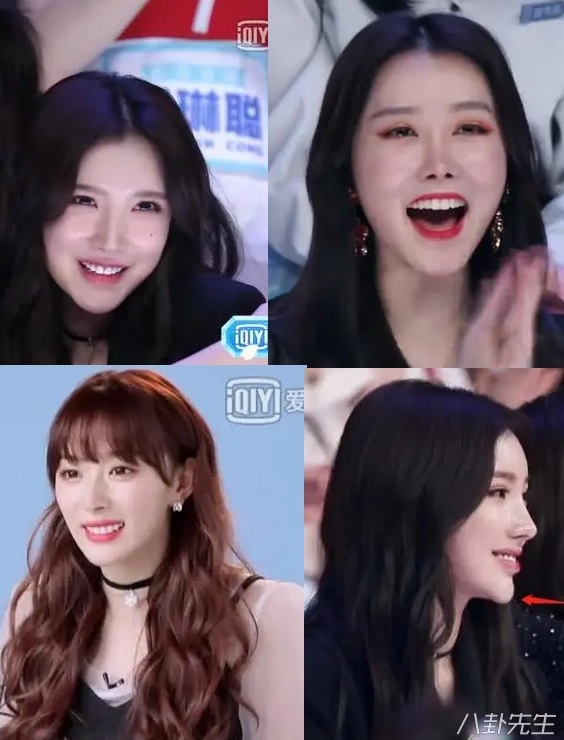 各届超女整容,2015年超女整容失败新闻案例