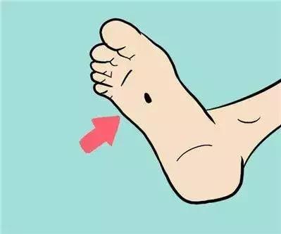 黑痣要除掉挂什么科,黑痣预防性去除有必要吗