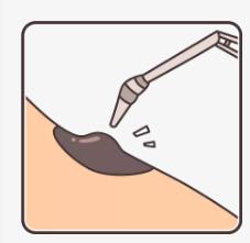 「健康」人无大“痣”,未必不是好事