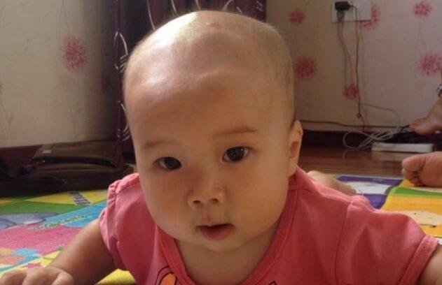 新生宝宝囟门跳动不明显,宝宝囟门受到撞击会影响智商吗