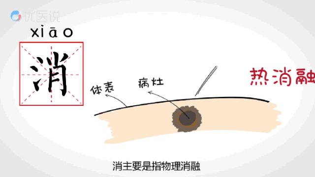 颅内肿瘤微创介入的条件,广东哪家医院肿瘤微创介入治疗好