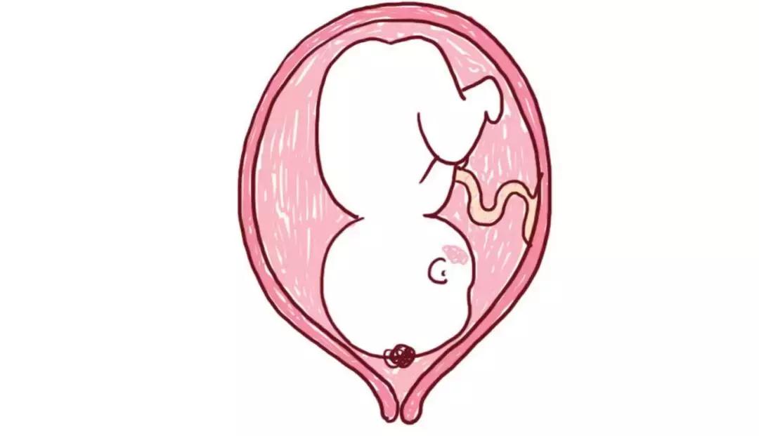 怀孕以后妈妈的内脏被挤到哪里去了?看完我不禁落泪了...