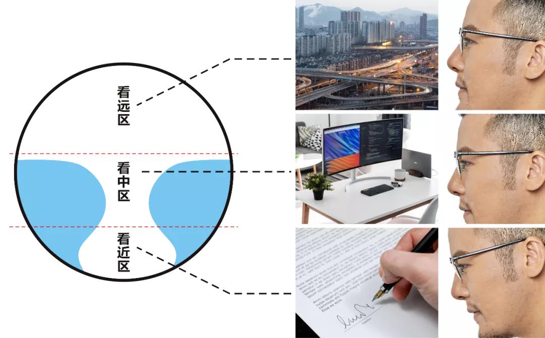 多焦点软镜对孩子近视有作用吗,普通镜和焦点镜有什么区别