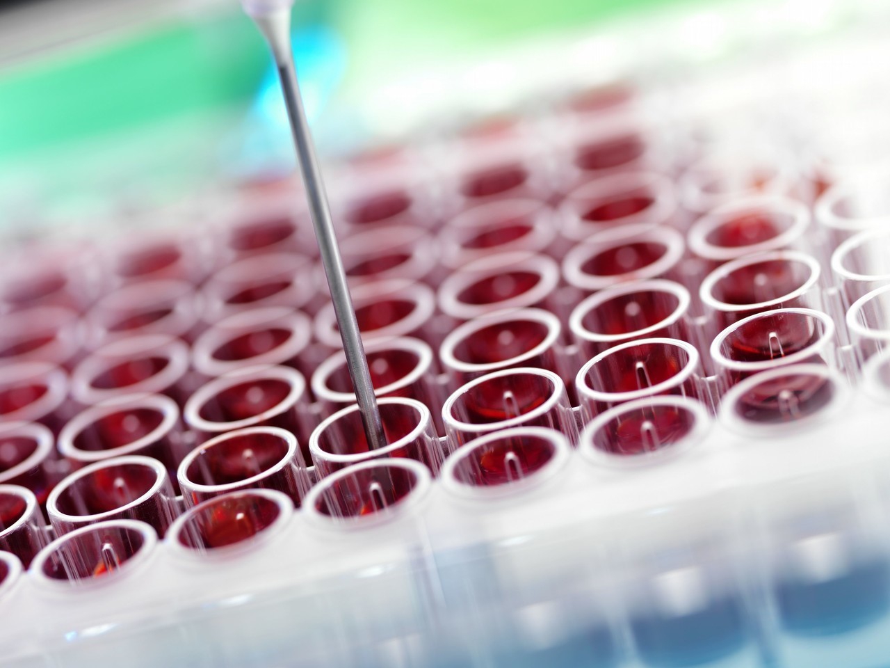 血气分析标本采集怎么处理,提高动脉血气分析标本采集成功率