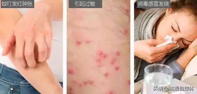 日本蚊子黑科技,灭蚊子神器日本