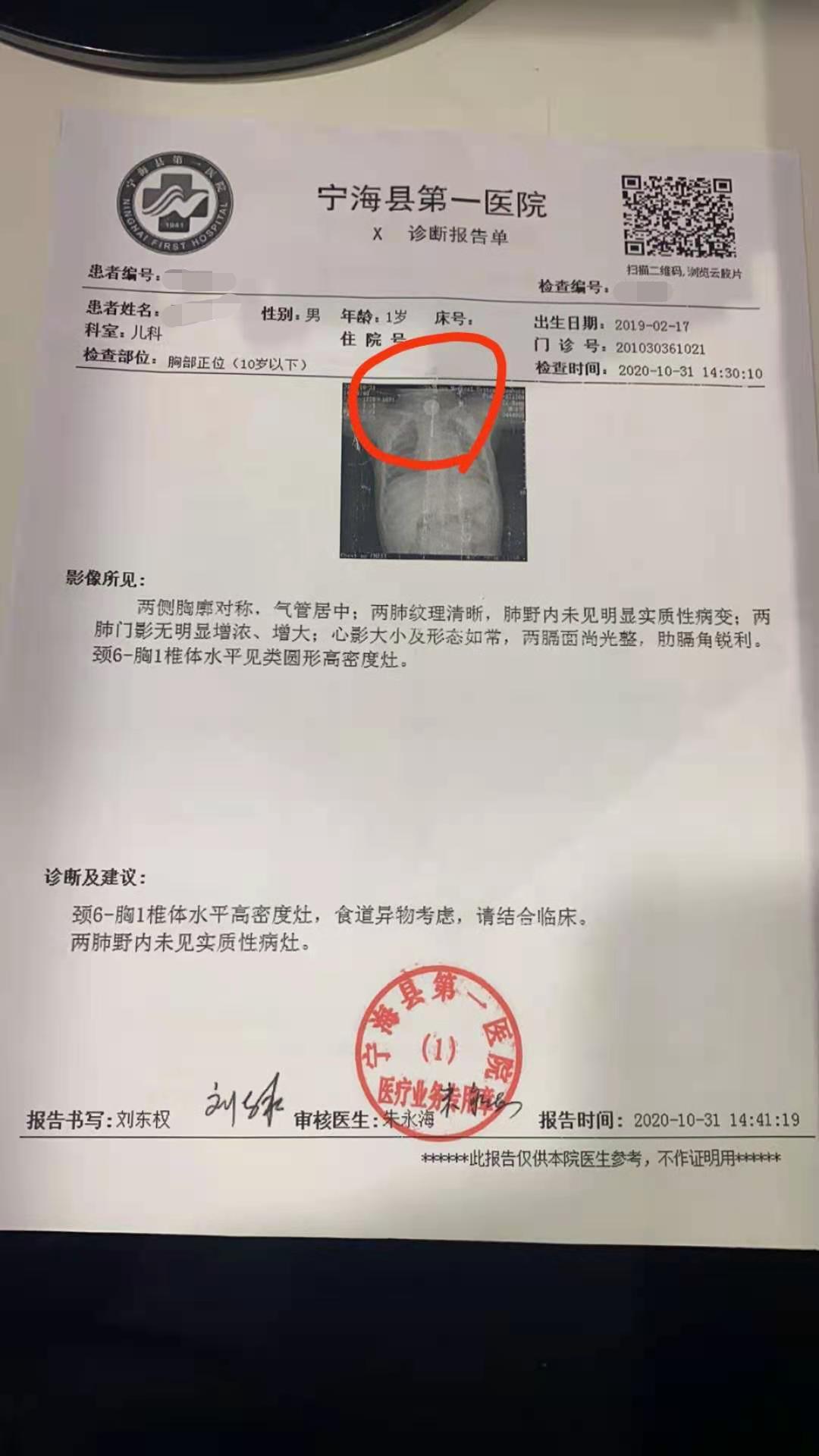 孩子误食了纽扣电池有什么症状,儿童误食纽扣电池应该怎么办