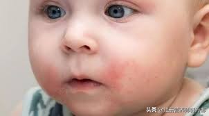 宝宝过敏拉肚子该吃的辅食,宝宝拉肚子过敏喝什么奶粉