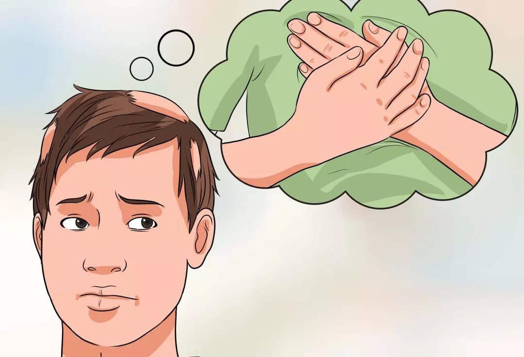 运动健身会导致女性斑秃吗,运动与脱发有什么关系