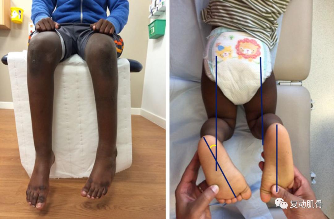 怎样分解八字求详细解说,解读八字教学