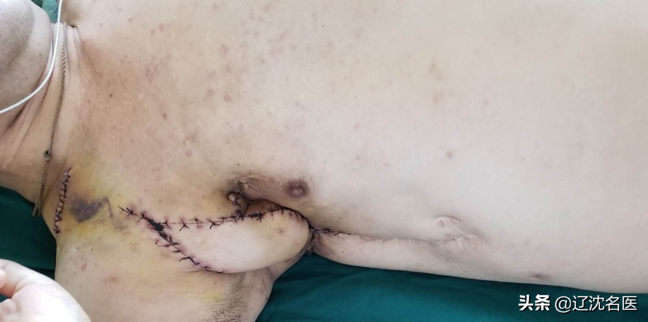 男子被病魔折磨10年,男人被病痛折磨20年