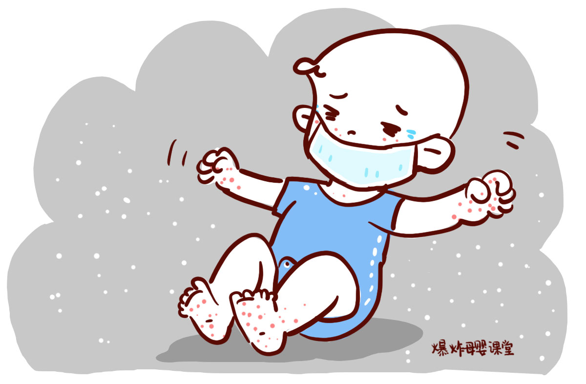 孩子得水痘需要注意什么事项,小孩得了水痘要怎么护理