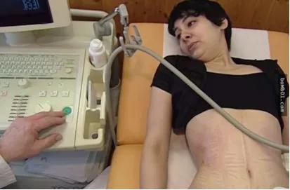 “内脏下垂、子宫脱落、漏尿”：扒一扒你不知道的网红束腰