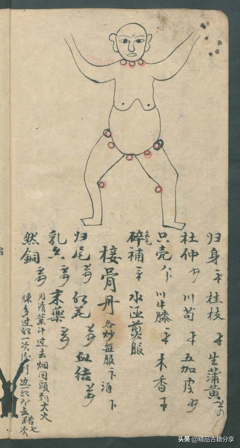 中医类抄本跌打损伤方面的医书欢迎阅读