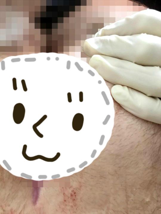 英国男孩怪病视频,男孩儿天生怪病浑身长满毛