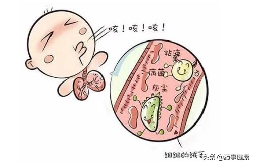 孩子久咳不愈警惕咳嗽变异性哮喘,久咳不愈有白痰喉咙发痒吃什么药