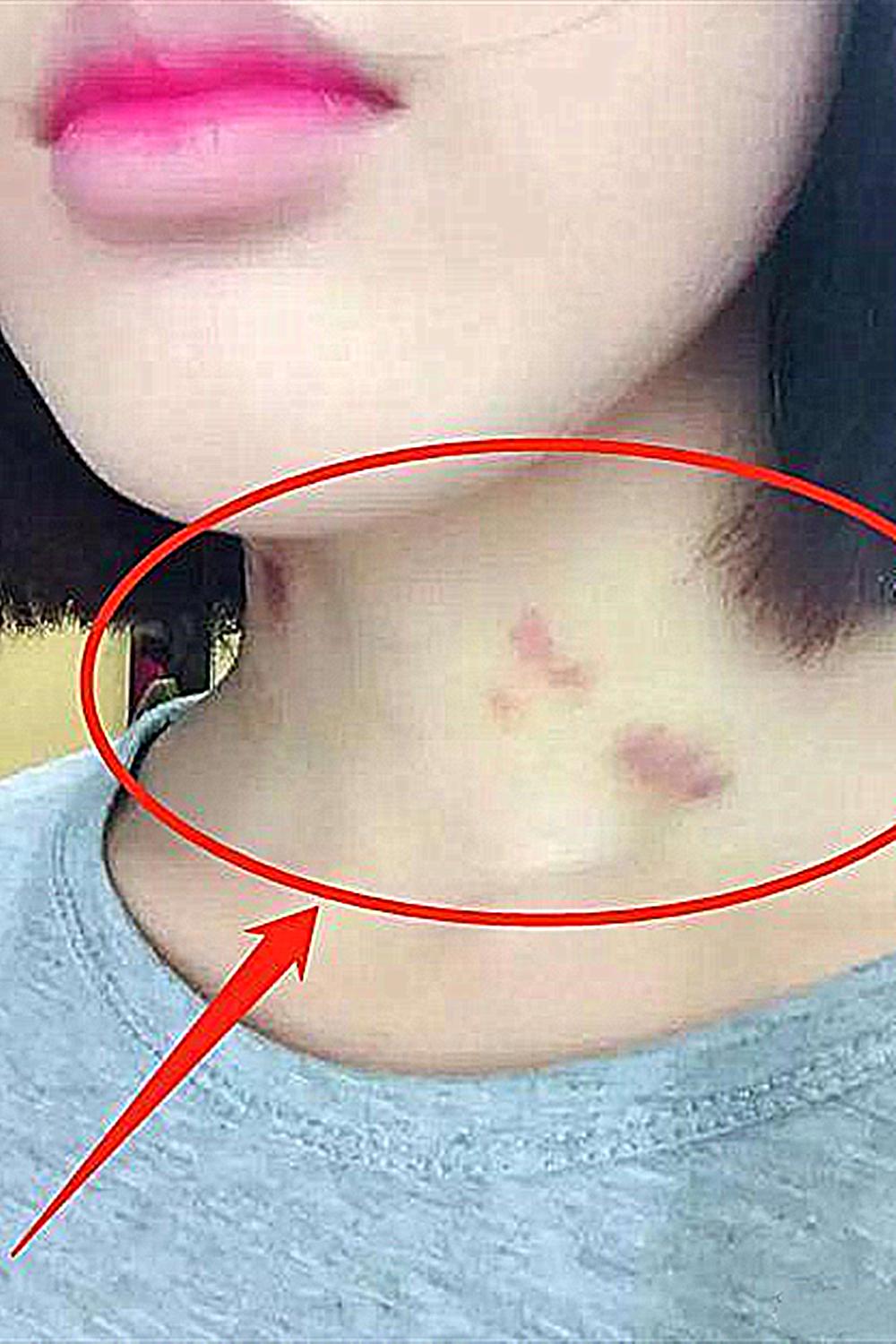 12岁女儿脖子出现“草莓吻痕”，爸爸不停逼问，孩子的话让人反思