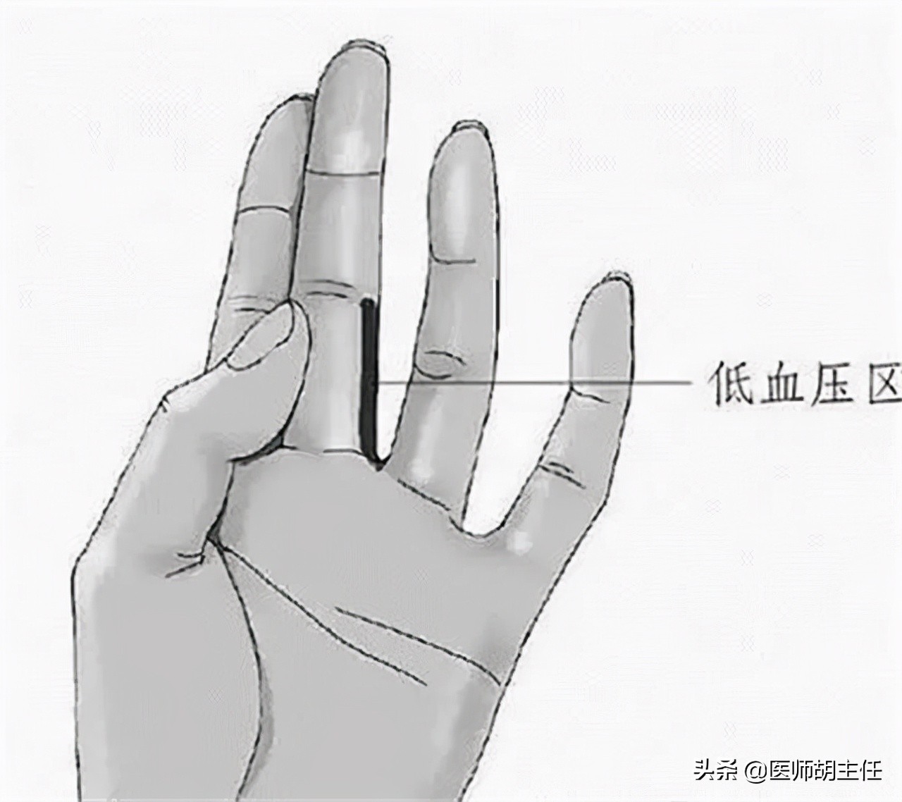 血压突然升高吃点什么急救药,血压低压偏高有什么中药好调理