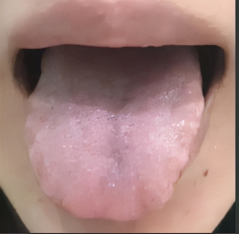 中医讲身体各个地方疼痛的原因,中医治全身疼痛最快方法